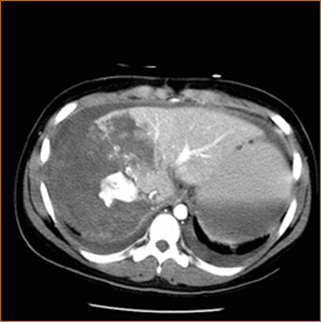 Contrast-enhanced CT abdomen teaching image